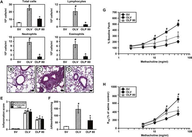 Figure 15. Effects of 4-PBA on total and differential cell counts in BAL fluids, histological changes, MPO activity, and airway hyperresponsiveness of OVA-LPS mice