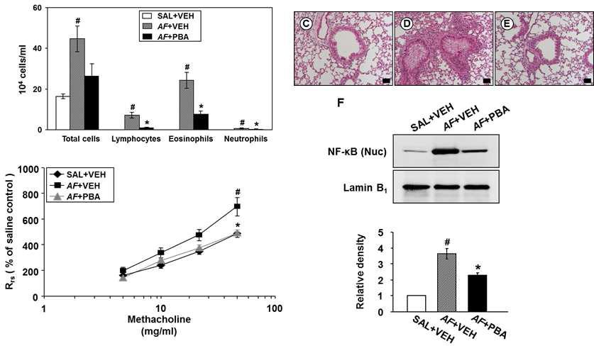 Effects of 4-PBA on total and differential cell counts in BAL fluids, histological changes, NF-kB nuclear translocation, and airway hyperresponsiveness of Aspergillus fumigatus-induced allergic asthmatic mice