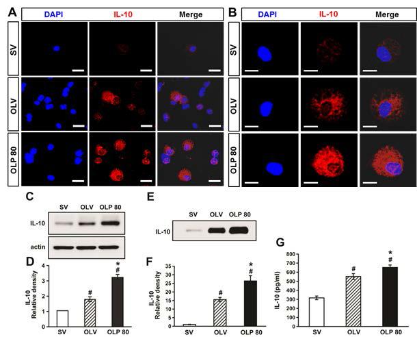 Inhibition of ER stress enhances IL-10 production in lung of OVA-LPS mice