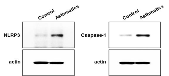 Levels of NLRP3 and caspase-1 in BALF from Asthmatics