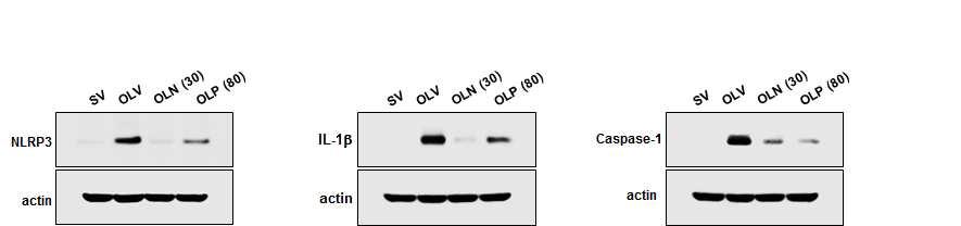 Interaction between ER stress and the activation of inflammasome in OVA-LPS mice