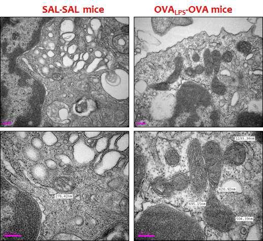 Mitochondrial hyperfusion in lung cells of OVA-LPS mice