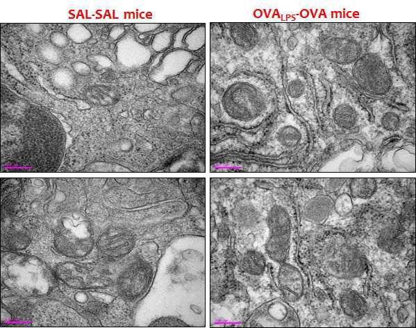 ER-mitochondrial morphological association in lung cells of OVA-LPS mice