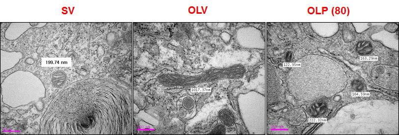 4-PBA restores the homeostasis of mitochondrial dynamics in inflammatory lung cells