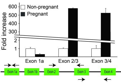 RT-qPCR로 측정한 각 exon의 발현정도 및 임신시의 변화