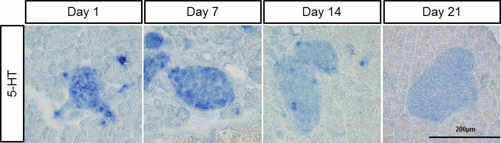 베타세포에서 출생 후 시기별 세로토닌 발현 양상.