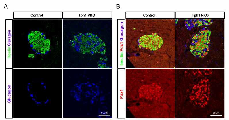 Tph1 PKO 마우스 췌도 구조가 비정상적임