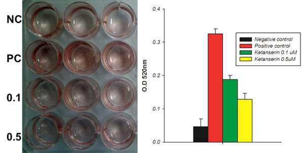 Htr2a antagonist 에 의한 adipogenesis 감소