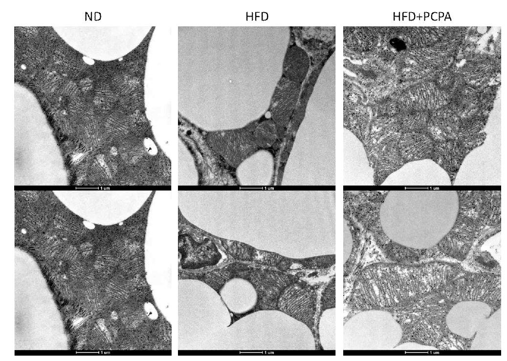 PCPA 투여 후 brown adipose tissue 의 전자현미경 소견