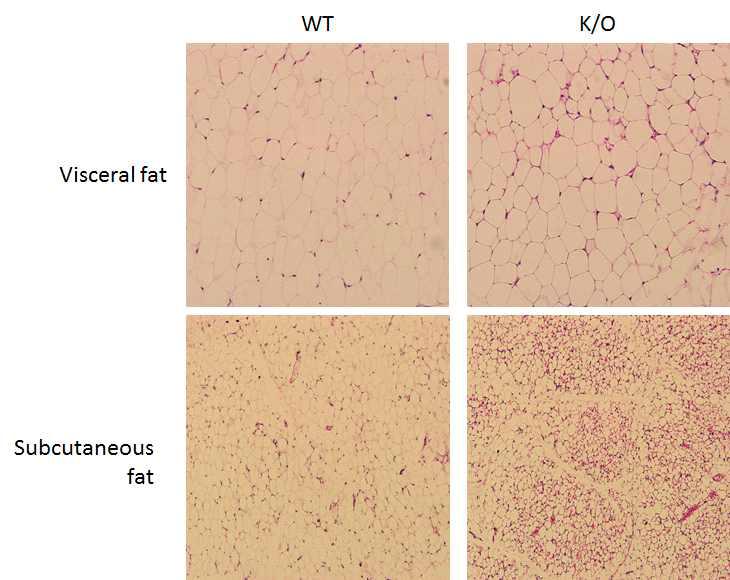 지방조직 특이 Tph1 K/O mouse 에서의 조직소견