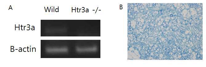 Electrophoresis gel of qPCR obtained from cDNA of brown adipose tissue (A), immunohistochemical staining of 5-HT using Vectastaiin ABC kit with rabbit Anti mouse Serotonin primary antibody (1:1000)