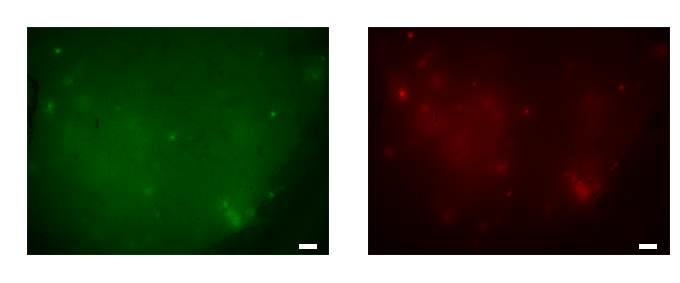 Window를 통한 islet imaging