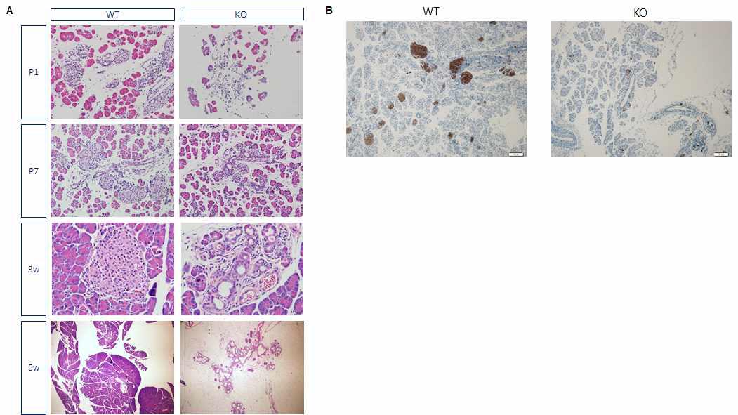 췌장 특이적 PRMT1 KO에서 인슐린 분비와 췌도 형성이 비정상적임