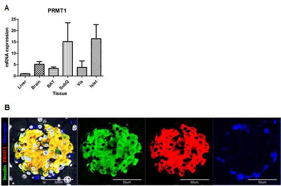 조직별 PRMT1 발현량과 췌도에서의 PRMT1 발현 양상
