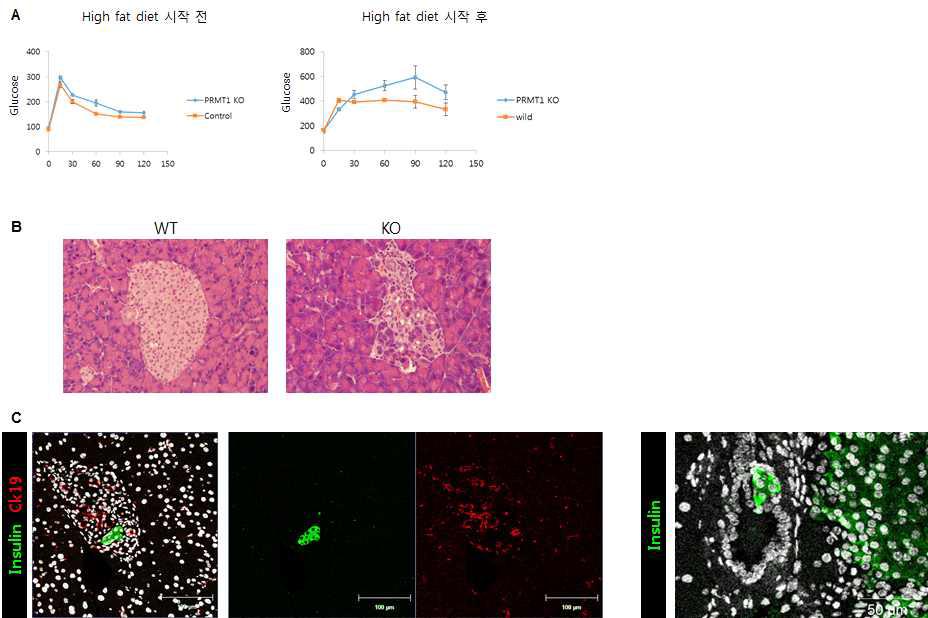 베타 세포 특이적 PRMT1 KO 마우스에 고지방식을 주었을 때의 혈중 포도당 농도 변화와 췌도의 구조적 결함.
