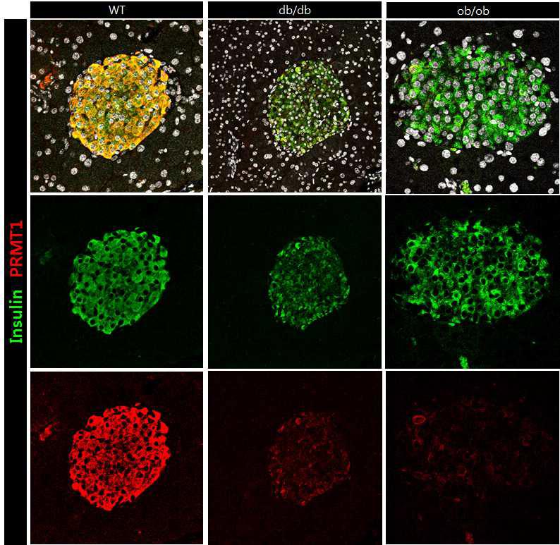 당뇨병 모델 마우스에서 PRMT1 발현의 감소.