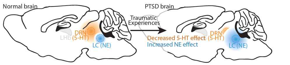 Normal vs. PTSD brain