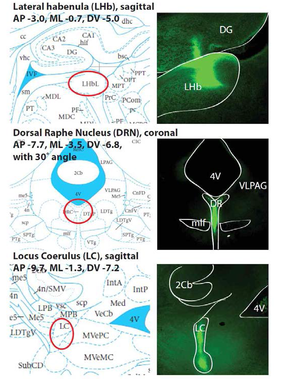 Examples of stereotaxic injection of Cholera toxin-488 into various target areas.