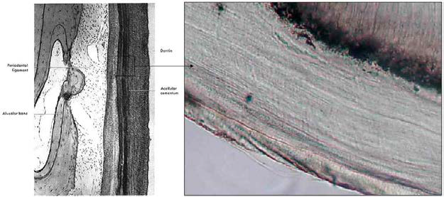 치아 백악질의 미세 해부학적 분석