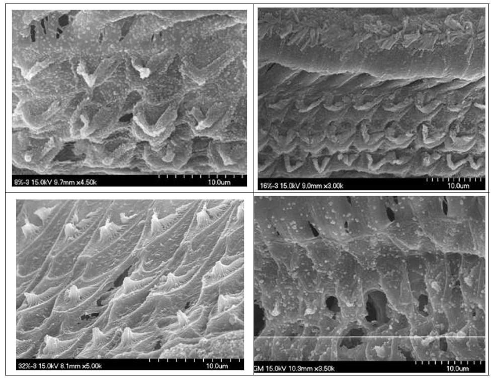 SEM shows almost normal hair cells in 8 to 32% YH1177 treated group and destruction of hair cells in gentamycin treated group