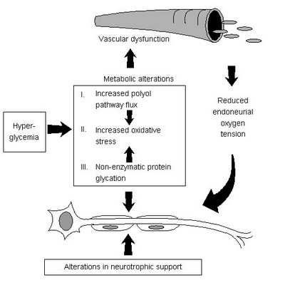 당뇨병성 신경병증의 원인
