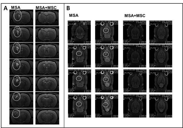 중간엽 줄기세포의 10x의 MRI 분석