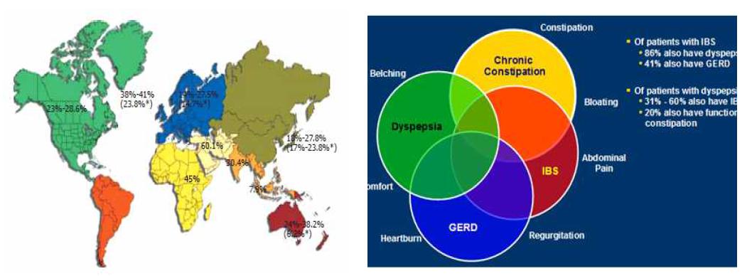 기능성소화불량증 유병률 및 overlap syndrome 유병율