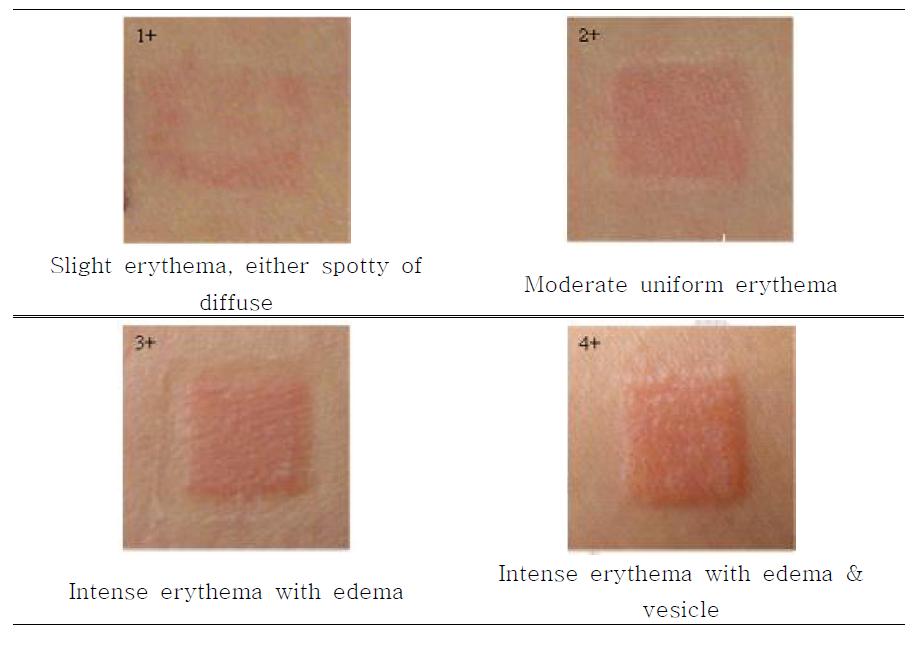 피부 반응에 대한 판정 기준