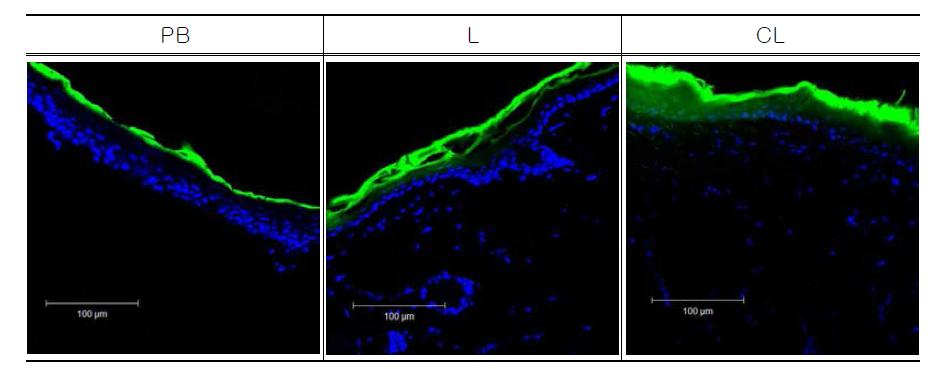PB 용액(PB), 리포좀(L) 및 양이온 리포좀(CL) 처리 후 쥐 피부의 CLSM 이미지.