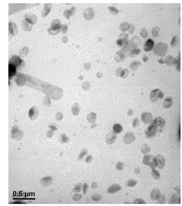 리포좀 안정화 제형 제조 12주 후 TEM 이미지.