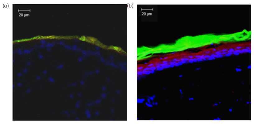 Hairless rat 피부에 Rhodamine B(red)와 FITC(green)를 담지한 각각의 시스템을 12 h 동안 처리한 후 단면을 cross-section하여 촬영한 CLSM 이미지 (a; 1,3-BG를 처리한 쥐 피부, b; DOPC를 처리한 쥐 피부). scale bar = 20 μm
