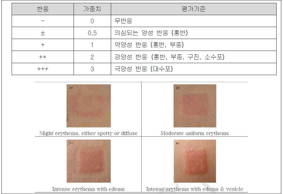 피부반응도 평가 기준반응 가중치 평가기준