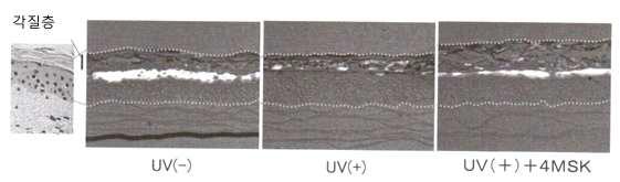 배양피부모델에서 각화관련인자에 대한 4MSK의 작용