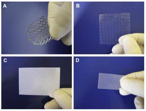 다양한 안와골절 치료용 삽입물. A) Titanium, B) Bioabsorbable C) Medpor, D) fibre reinforced mesh