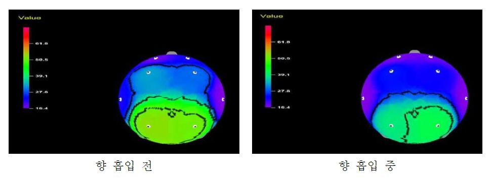 향 흡입 전과 향 흡입 중의 brain mapping