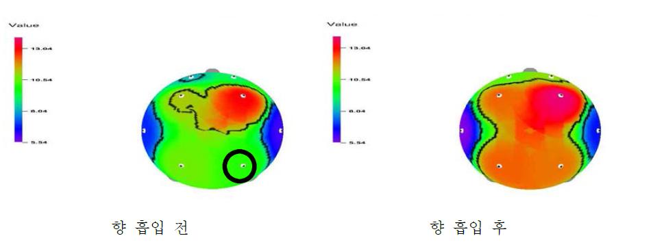 Brain map으로 본 귀비탕 향료 흡입