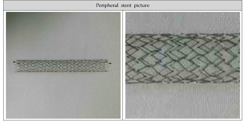 Peripheral stent picture