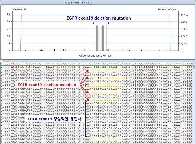 NGS 돌연변이 검출의 분석 결과 예시