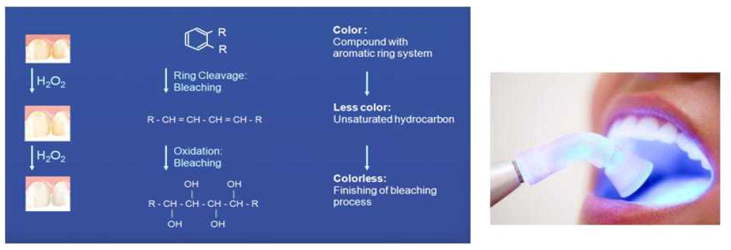 과산화수소을 처치한 치아의 미백 메커니즘과 광 활성화