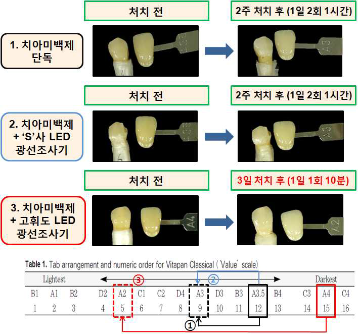 고휘도 LED 광선조사기의 발거치 유효성 평가 결과