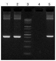 HPV PCR 산물 lane 1,4 :HPV145 bp산물 lane2: Marker lane3: IC