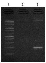 NG PCR 산물 lane1.2.5: 420 bp 4. negative std