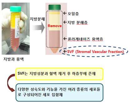 기질혈관분획(SVF)