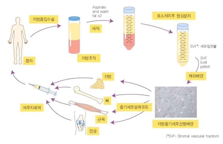 기질혈관분획 분리 방법