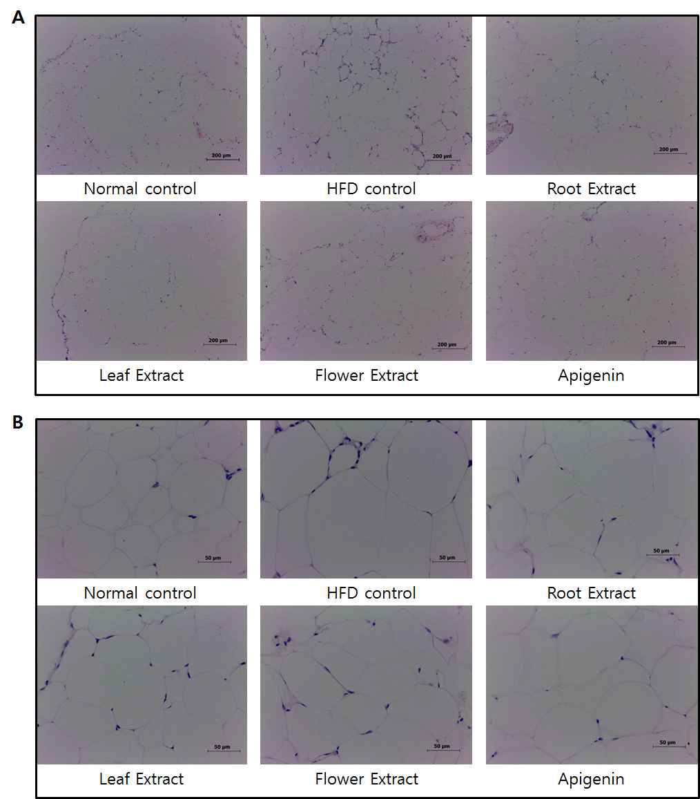 비만 마우스(C57BL/1_에서 엉겅퀴 부위별 추출물의 투여가 부고환 지방조직 세포의 변화에 미치는 효과. 비만을 8주간 유도한 후 재료 및 방법과 같이 6 그룹으로 나누어 다시 8주간 고지방 사료와 엉겅퀴 부위별 추출물을 투여한 후 부고환 지방조직을 대상으로 H&E염색을 하여 현미경으로 관찰였다. (A): 100 X, (B) 400X.