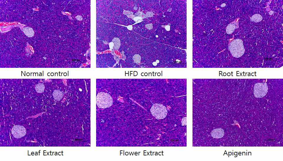 비만 마우스(C57BL/1_에서 엉겅퀴 부위별 추출물의 투여가 췌장조직의 소도 변화에 미치는 효과. 비만을 8주간 유도한 후 재료 및 방법과 같이 6 그룹으로 나누어 다시 8주간 고지방 사료와여du 현미경으로 관찰하였다. 100 X.