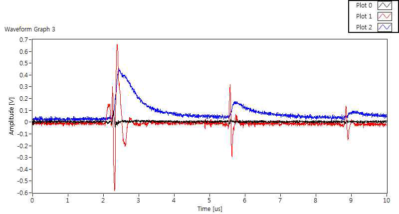 Ultrasonic echo & processed signals