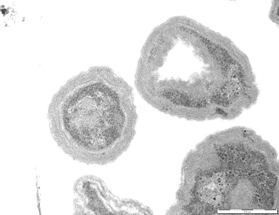 연구책임자가 하수처리장으로부터 분리/동정한 암모니아산화균 (Nitrosomonas sp. ML1)