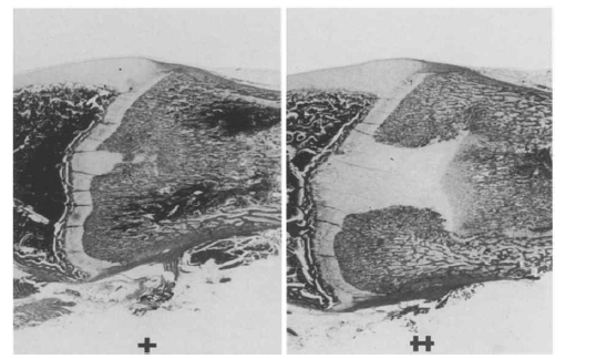 대퇴골 끝단 성장판에서의 조직학적 변화 및 골 성장 유도 사진