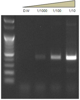 16S Ribosomal RNA PCR